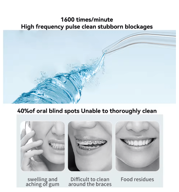 Oral Irrigator – Rechargeable Water Flosser for Deep Teeth & Gum Cleaning
